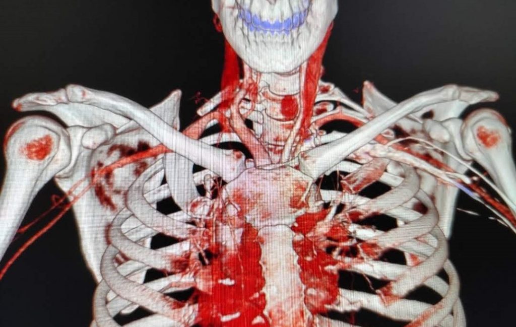 TOS 3D Röntgenbild
